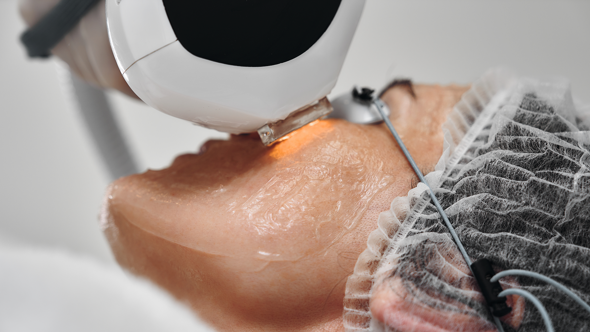 adult-receiving-laser-treatment-in-hospital-settin-2026-03-20-06-12-08-utc