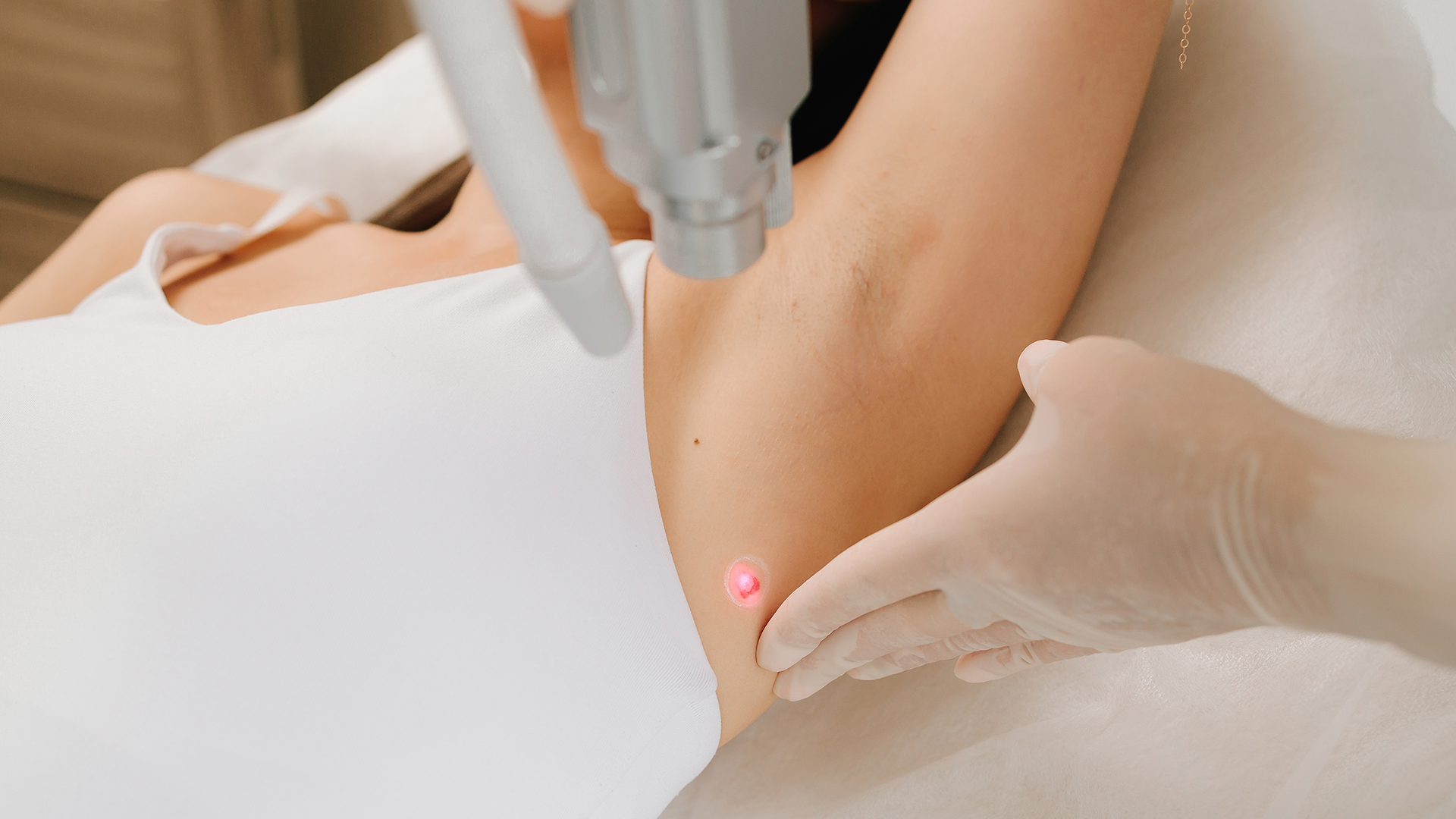 laser-hair-removal-treatment-at-a-medical-spa-2026-04-04-23-42-36-utc